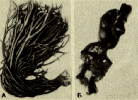 . 8-9.    ( Chlrophyta): A. Codium. . Ulva ( ) ( R.D.Allen.)