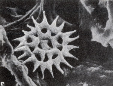 . 8-11. Pediastrum ()  Hydrodictyon () -    . (,       Harvey Merchant.)