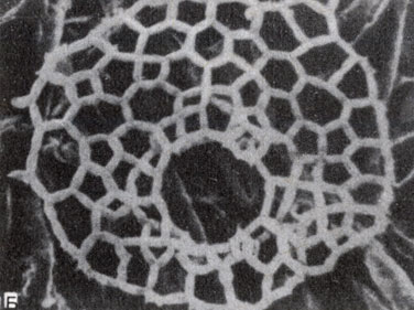 . 8-11. Pediastrum ()  Hydrodictyon () -    . (,       Harvey Merchant.)