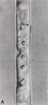 . 8-12.    : A. Mougeotia ( N. S. Allen.)