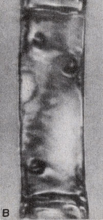 . 8-12.    : . Oedogonium ( N. S. Allen.)