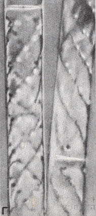 . 8-12.    : . Spirogyra. ( N. S. Allen.)