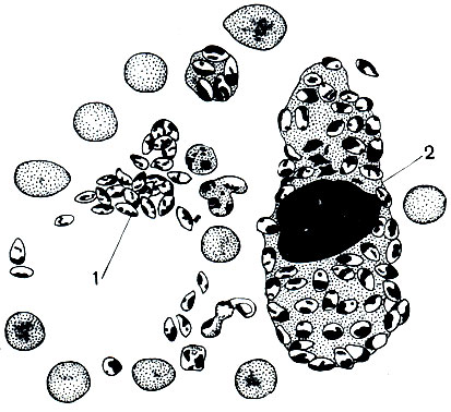 . 60.    ( ) Leishmania tropica: 1 -  ,    ; 2 -    