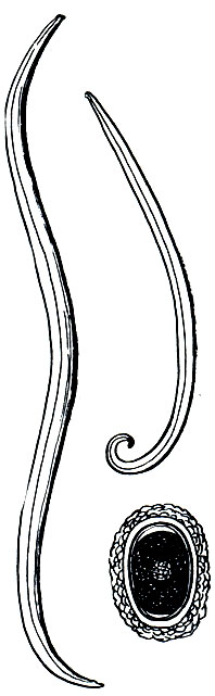 . 239.   (Ascaris lumbricoides):  - ,  - , - 