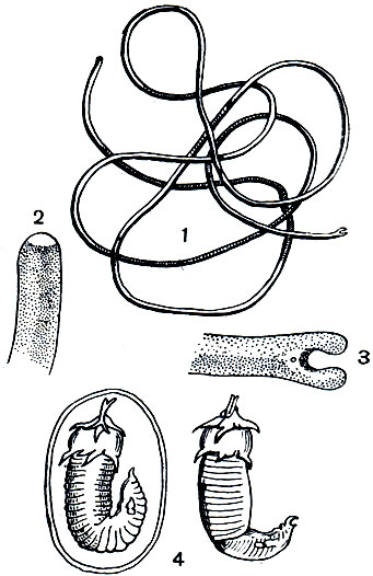 . 255. : 1 - Gordius aquaticus; 2 -  ; 3 -      ; 4 -        