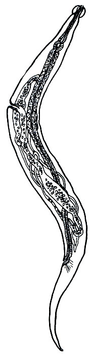 . 238.  (Enterobius vermicularis)