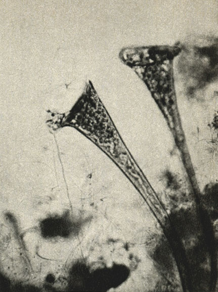   (Stentor coeruleus)