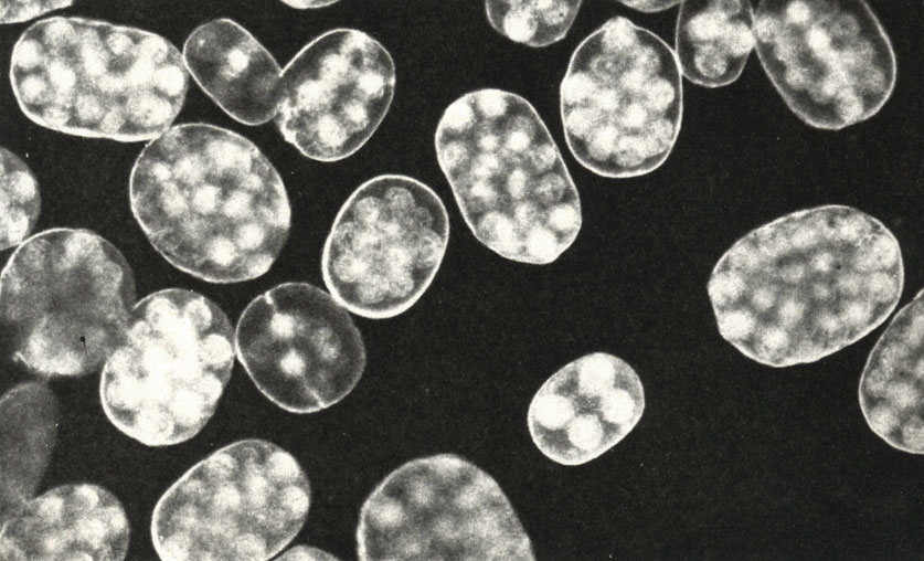    (Dipilidium canirtum)