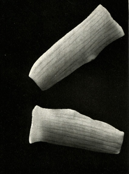   ,  ,  (Taeniarhynchns saginatus)