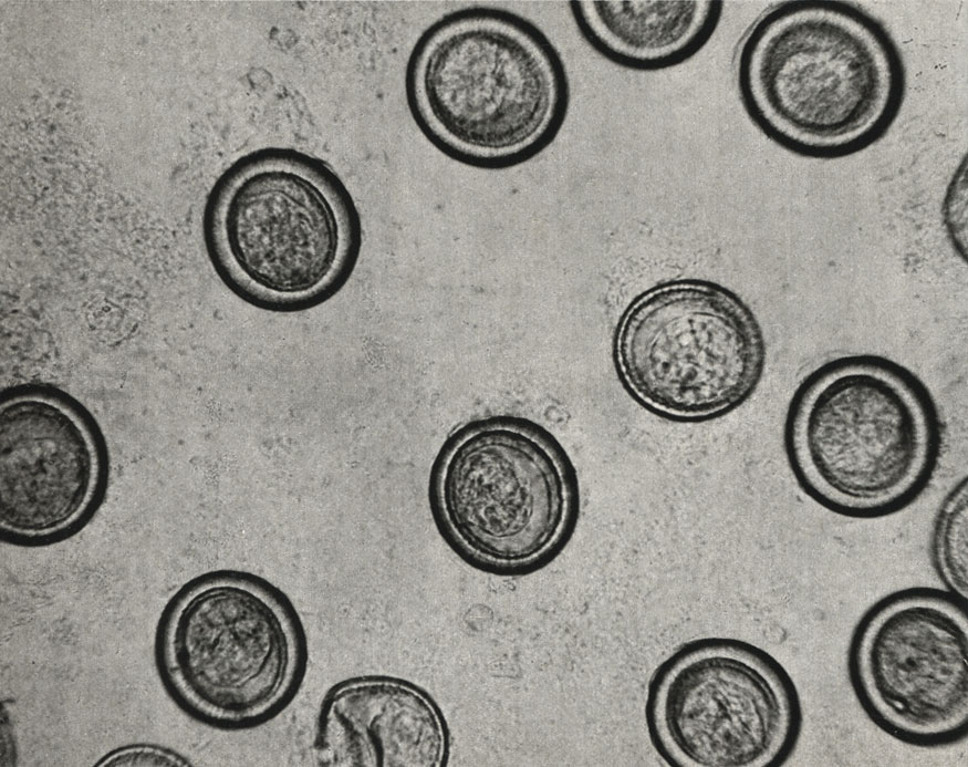    (Taenia solium)