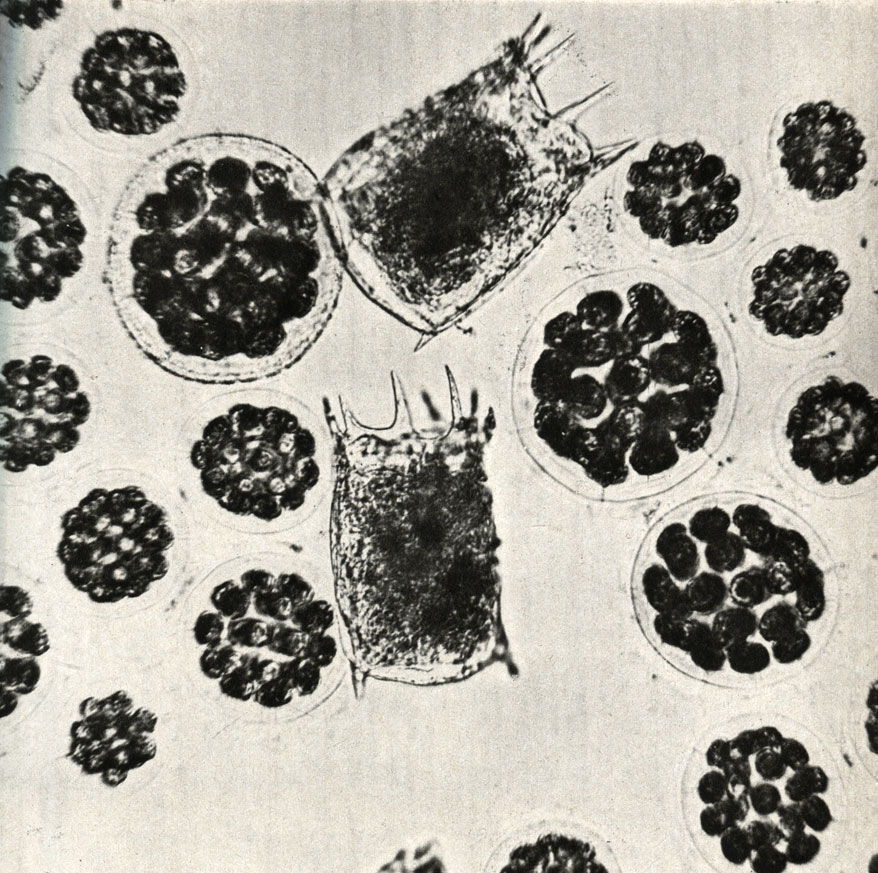  Keratella quadrat.            Eudorina elegans