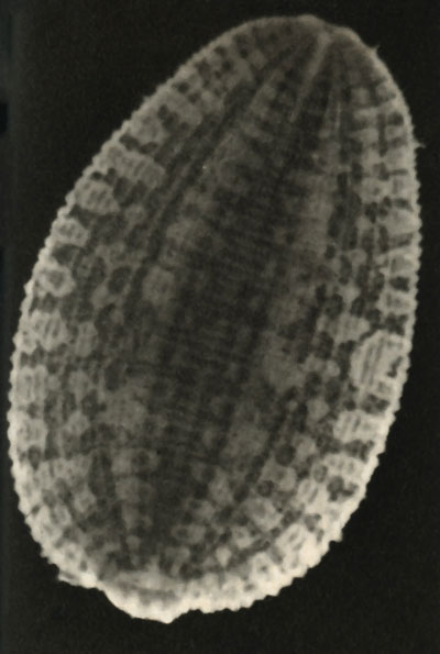   (Glossiphonia complanata),  