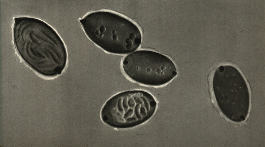     (Herpobdella octoculata)
