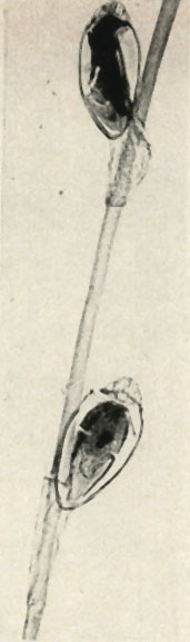    (Phthirus pubis),    