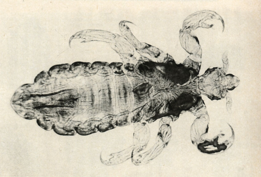   (Pediculus humanus capitis)